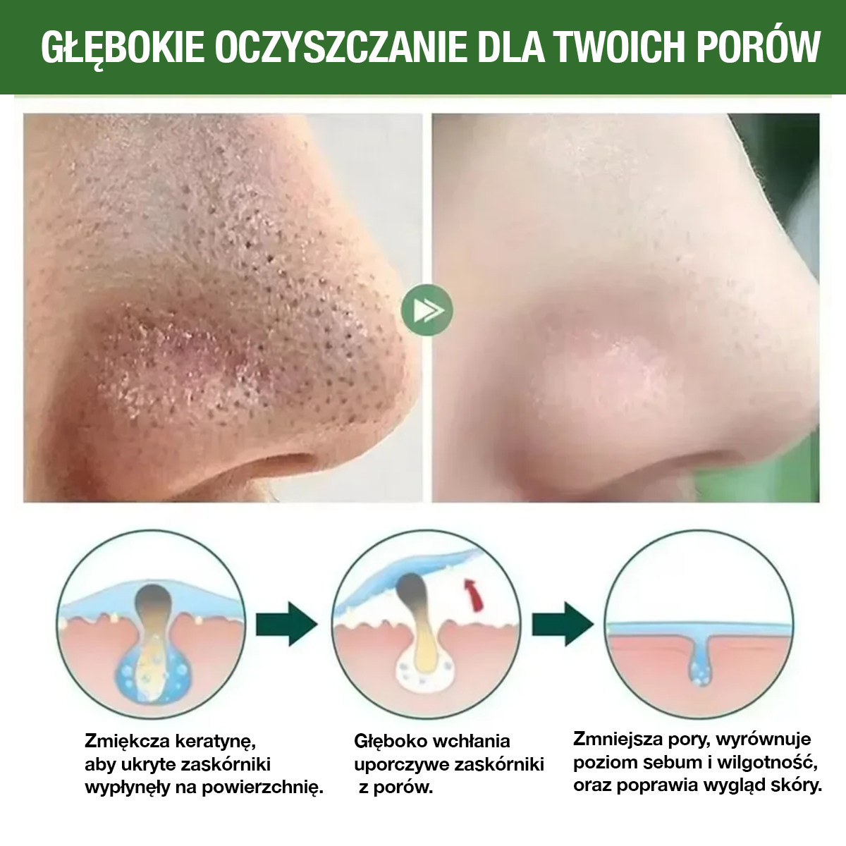 GreenMask® – Głębokie oczyszczanie twarzy (Oferta 2 w cenie 1)