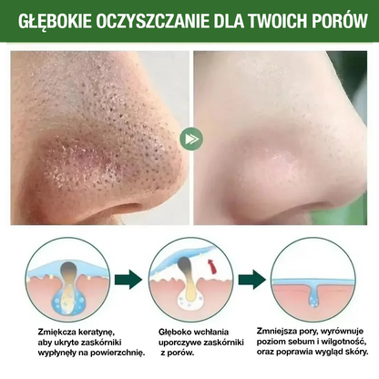 GreenMask® – Głębokie oczyszczanie twarzy (Oferta 2 w cenie 1)